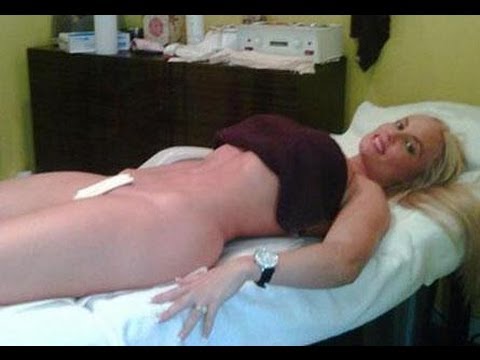 Brazilian Wax Demonstration